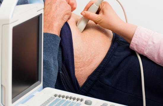 cancer-de-colon-coi-img3