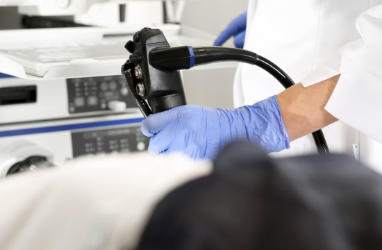 cancer-de-colon-coi-img4